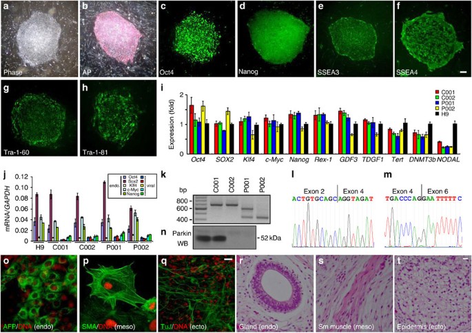 Parkin Controls Dopamine Utilization In Human Midbrain Dopaminergic Neurons Derived From Induced Pluripotent Stem Cells Nature Communications Parkin Controls Dopamine Utilization In Human Midbrain Dopaminergic Neurons Derived From Induced Pluripotent Stem Cells Nature Communications