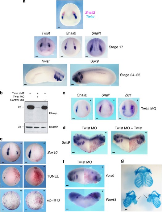 Interactions between twist and other core epithelial–mesenchymal transition factors are controlled by gsk3-mediated phosphorylation