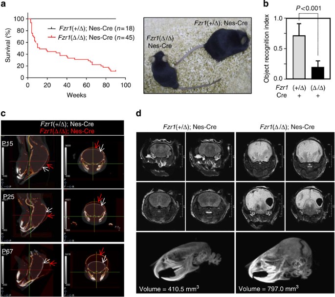 The APC/C cofactor Cdh1 prevents replicative stress and p53-dependent cell death in neural progenitors | Nature Communications the-apc-c-cofactor-cdh1-prevents-replicative-stress-and-p53-dependent-cell-death-in-neural-progenitors-nature-communications