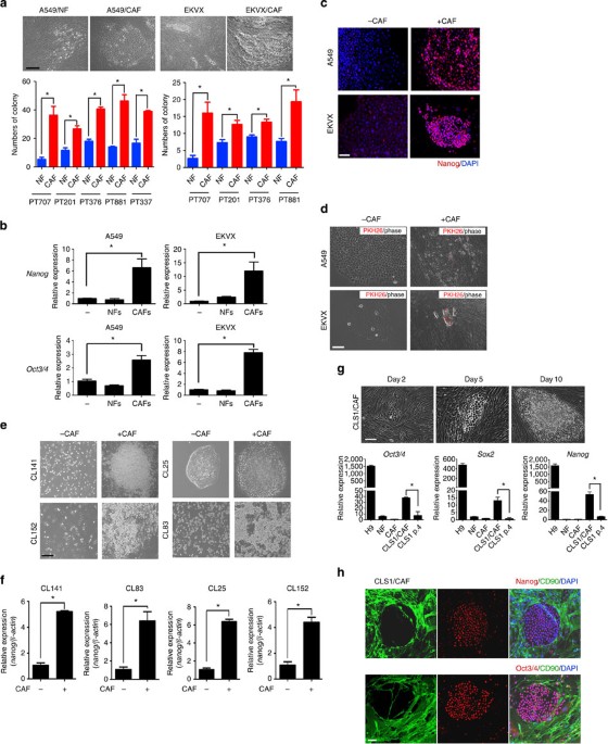 Cancer-associated fibroblasts regulate the plasticity of lung 