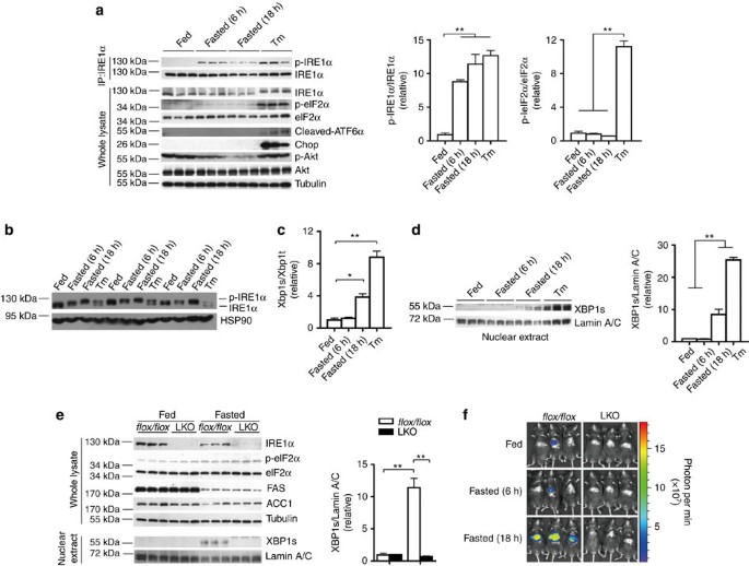 Hepatic IRE1α regulates fasting-induced metabolic adaptive programs through the XBP1s–PPARα axis signalling
