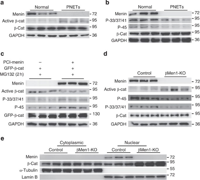 Targeting B Catenin Signaling For Therapeutic Intervention In Men1 Deficient Pancreatic Neuroendocrine Tumours Nature Communications Targeting B Catenin Signaling For Therapeutic Intervention In Men1 Deficient Pancreatic Neuroendocrine Tumours Nature Communications