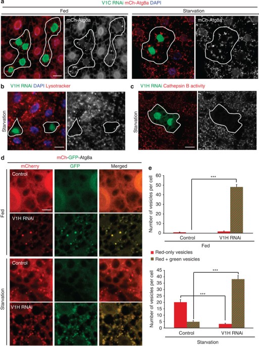 Autophagosome–lysosome fusion is independent of V-ATPase-mediated  acidification | Nature Communications