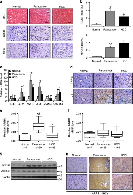B Arrestin1 Enhances Hepatocellular Carcinogenesis Through Inflammation Mediated Akt Signalling Nature Communications