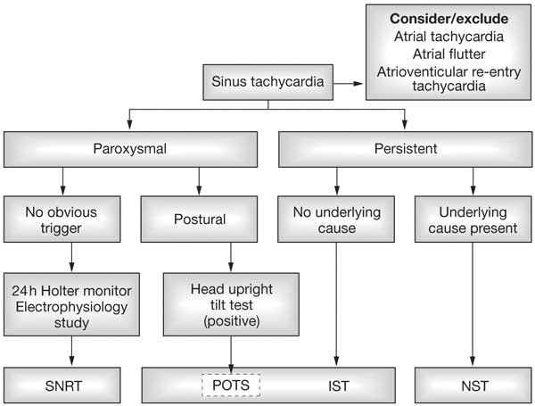 The Sinus Tachycardias Nature Reviews Cardiology