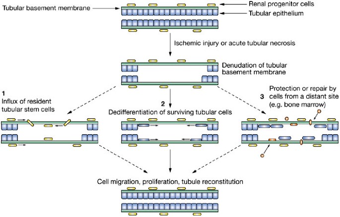 Adult stem cells in the repair of the injured renal tubule