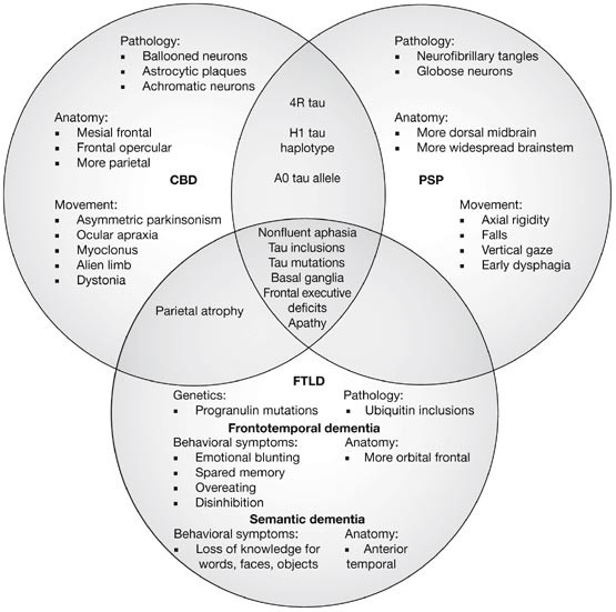 Are Frontotemporal Lobar Degeneration Progressive Supranuclear Palsy And Corticobasal Degeneration Distinct Diseases Nature Reviews Neurology