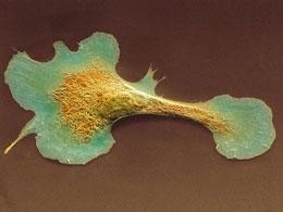 Stem cells patch up 'broken' heart