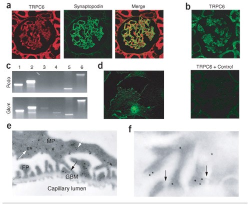 Trpc6 is a glomerular slit diaphragm-associated channel required for normal renal function