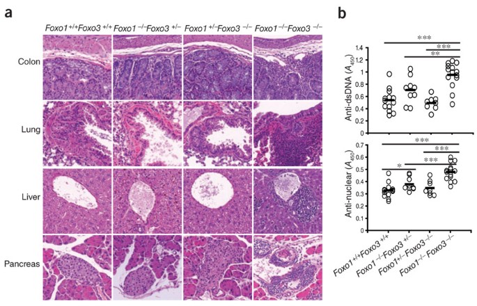 Foxo proteins cooperatively control the differentiation of foxp3+ regulatory t cells