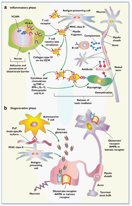 Multiple sclerosis: a two-stage disease | Nature Immunology