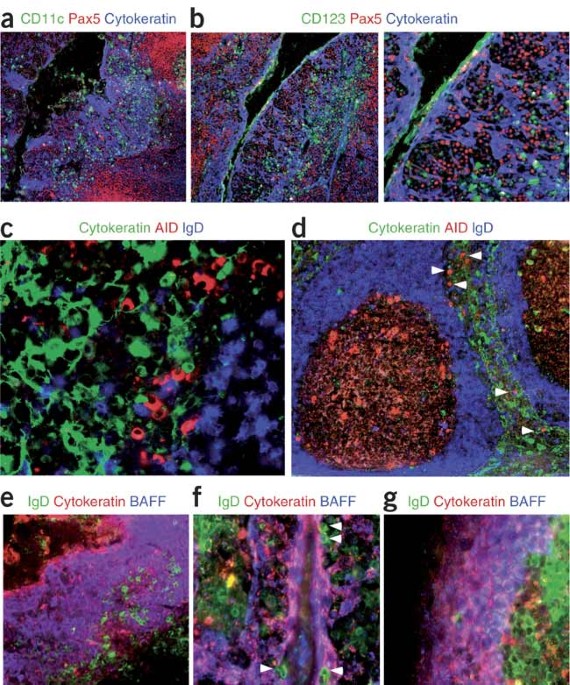 Epithelial cells trigger frontline immunoglobulin class switching through a pathway regulated by the inhibitor slpi