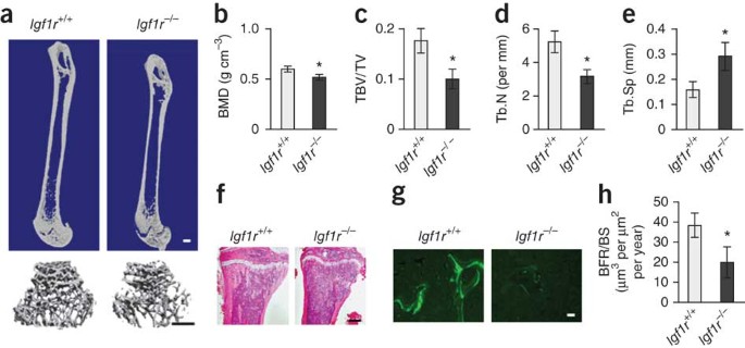 igf 1 lr3 bone growth Matrix IGF-1 maintains bone mass by activation of mTOR in mesenchymal stem  cells