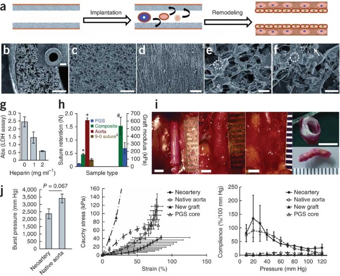 Fast-degrading elastomer enables rapid remodeling of a cell-free synthetic graft into a neoartery