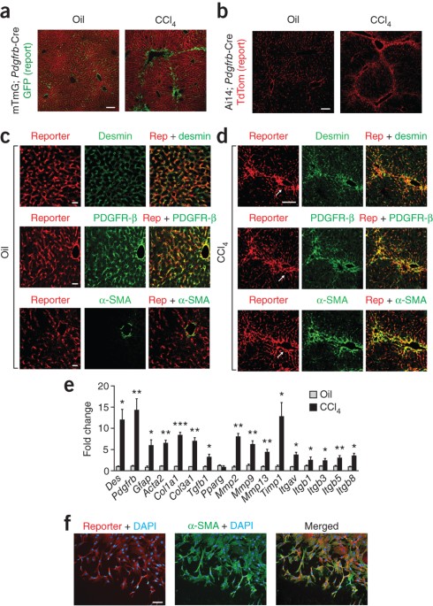 Targeting of αv integrin identifies a core molecular pathway that regulates fibrosis in several organs