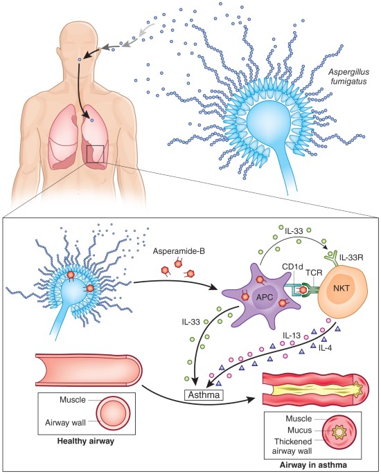 asthma and cigarette smoking Underlying inflammatory mechanisms for the mixed asthma-smoking Avoiding Tobacco Smoke and E-Cigarette
