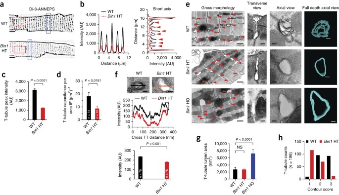 Cardiac Bin1 Folds T Tubule Membrane Controlling Ion Flux And Limiting Arrhythmia Nature Medicine