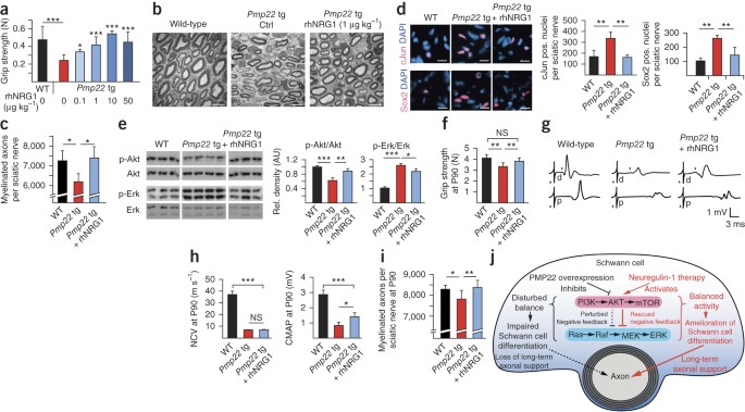 Imbalance of Neuregulin1-ErbB2/3 signaling underlies altered myelin  homeostasis in models of Charcot-Marie-Tooth disease type 4H