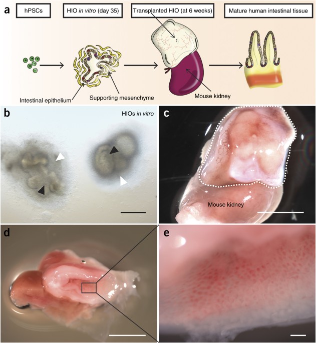 humán papillómában in vitro A vastagbélrák utolsó fázisának tünetei