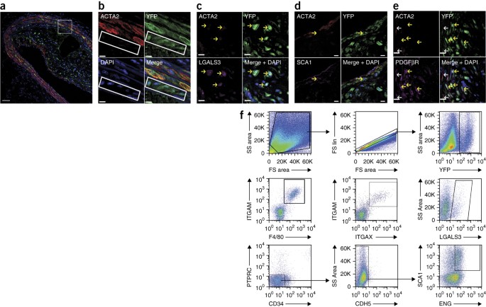 Klf4 Dependent Phenotypic Modulation Of Smooth Muscle Cells Has A Key Role In Atherosclerotic Plaque Pathogenesis Nature Medicine