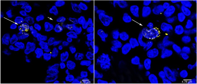 Defining total-body AIDS-virus burden with implications for