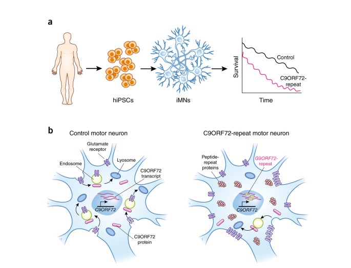 A human cellular model of amyotrophic lateral sclerosis | Nature Medicine