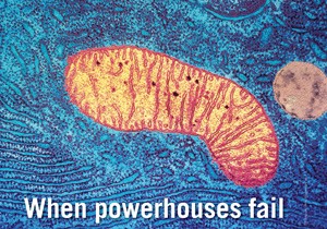 When powerhouses fail | Nature Medicine