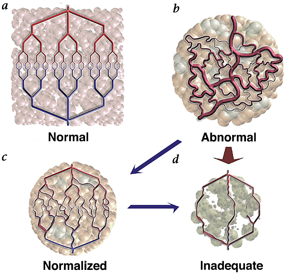 IL-3 is a novel target to interfere with tumor vasculature