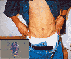 feature-image