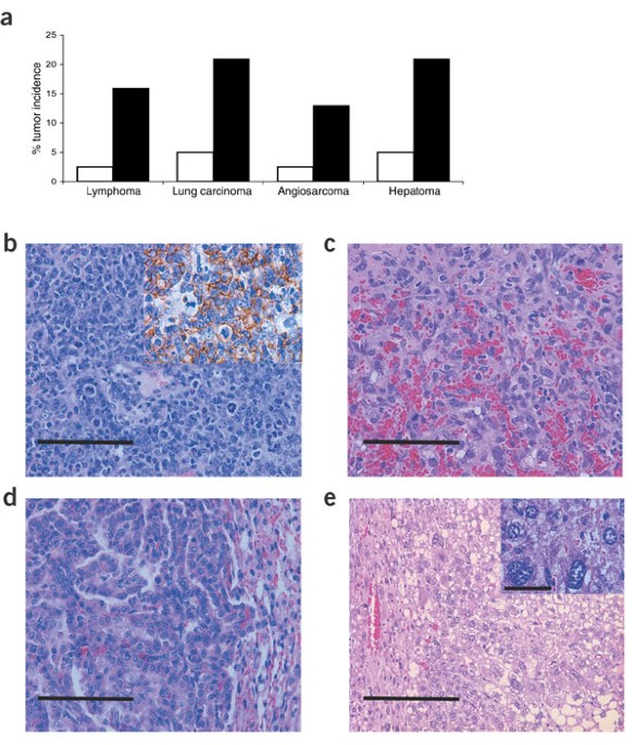 The translation factor eIF-4E promotes tumor formation and cooperates with c-Myc in lymphomagenesis