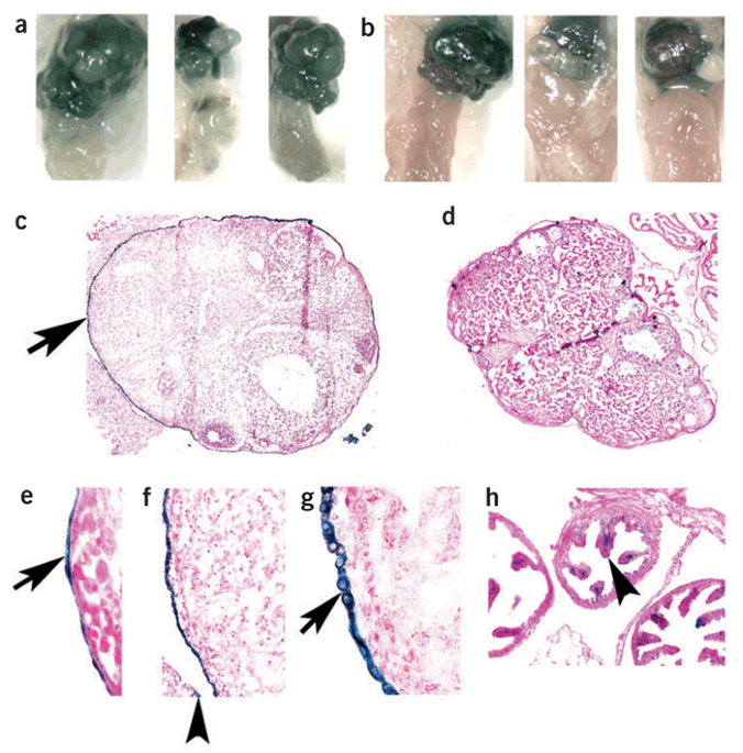 Role of k-ras and pten in the development of mouse models of endometriosis and endometrioid ovarian cancer