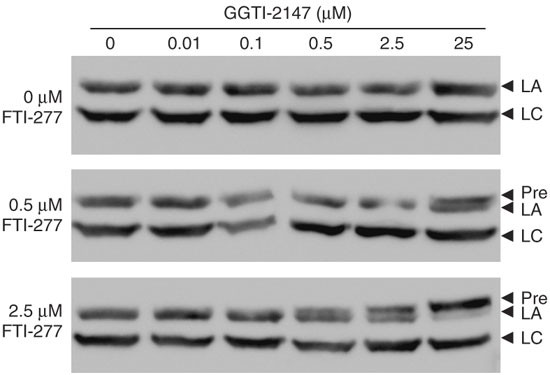 Combined treatment with statins and aminobisphosphonates extends longevity in a mouse model of human premature aging