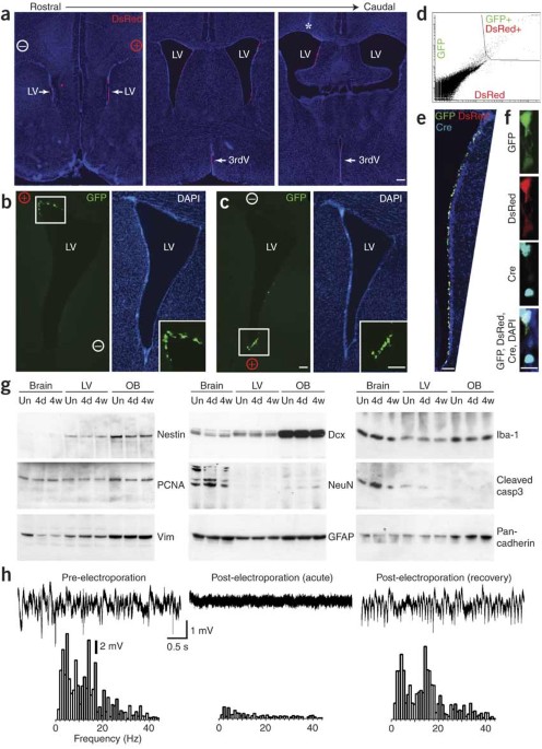 Genetic manipulation of adult mouse neurogenic niches by in vivo electroporation