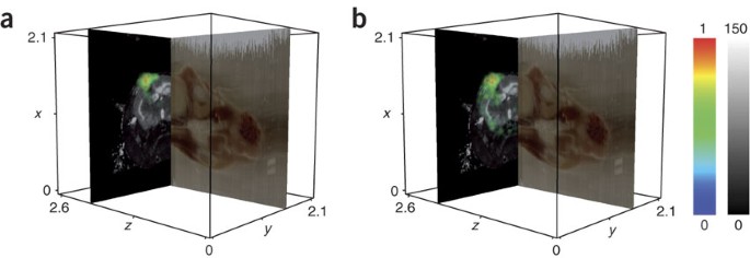 Integrating spatially resolved three-dimensional maldi ims with in vivo magnetic resonance imaging