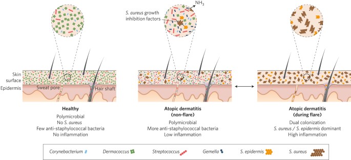 Taming Staphylococcus aureus in the eczema skin microbiome