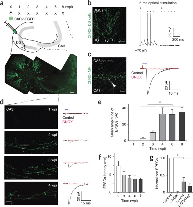 Optical controlling reveals time-dependent roles for adult-born dentate granule cells | Nature Neuroscience optical-controlling-reveals-time-dependent-roles-for-adult-born-dentate-granule-cells-nature-neuroscience