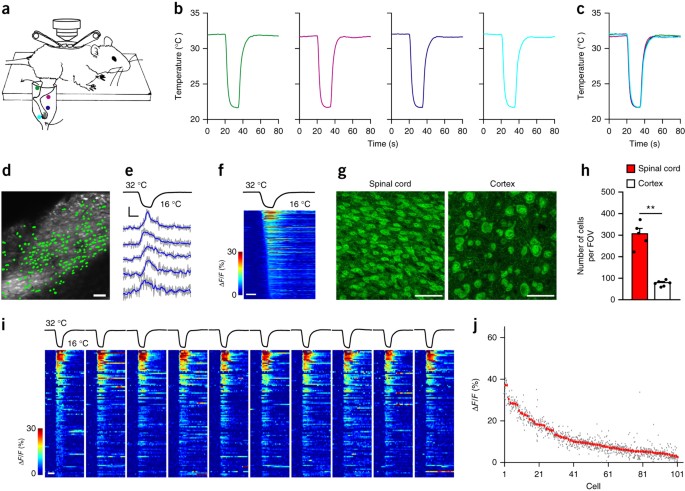 The Coding Of Cutaneous Temperature In The Spinal Cord Nature Neuroscience