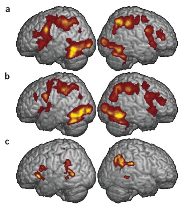 Development of neural mechanisms for reading Biology Diagrams