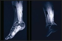 feature-image