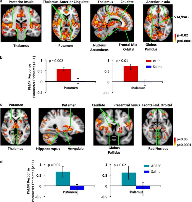 Imaging drugs with and without clinical analgesic efficacy