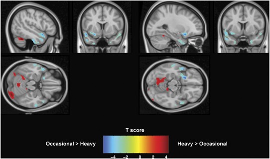                               Neuropsychopharmacology                          volume  39, pages  2041–2048 (2014 )Cite this article              