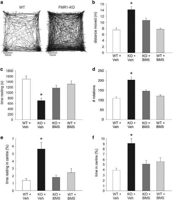 Potential Involvement Of Impaired Bk Ca Channel Function In - 