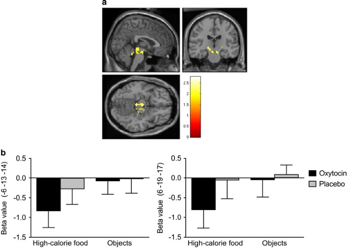 Effects of intranasal oxytocin on the blood oxygenation level-dependent signal in food motivation and cognitive control pathways in overweight and obese men
