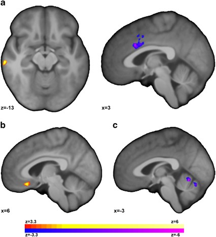 Multimodal investigation of network level effects using intrinsic functional connectivity, anatomical covariance, and structure-to-function correlatio