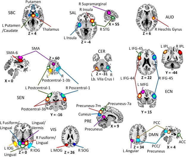The impact of combinations of alcohol, nicotine, and cannabis on dynamic brain connectivity