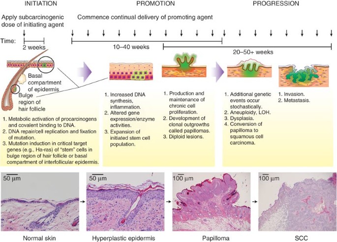 Multi-stage chemical carcinogenesis in mouse skin: Fundamentals and  applications | Nature Protocols