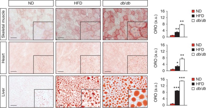 Imaging of neutral lipids by oil red O for analyzing the metabolic status in health and disease
