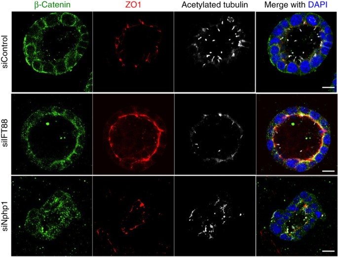  pedomom mir 23 pedomoms mir"here 03 A Genetic Screen Implicates miRNA-372 and miRNA-373 As Oncogenes in  Testicular Germ Cell Tumors