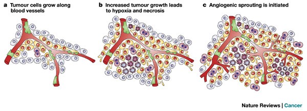 Tumorigenesis and the angiogenic switch | Nature Reviews Cancer