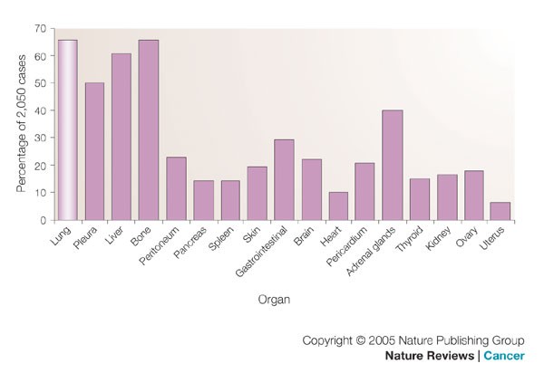 Breast Cancer Metastasis Markers And Models Nature Reviews Cancer
